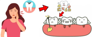 Read more about the article Dental Cyst/Radicular Cyst/Periapical Cyst