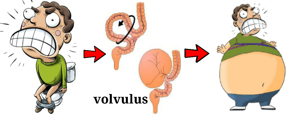 You are currently viewing Volvulus